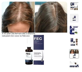 FEG Hair Growth Spray